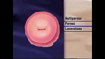 Female Vagina And Anus Check.
